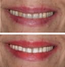 Studio Dentistico Dott. Francesco Rossani logo