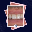 Studio Dentistico - Faccette dentali logo