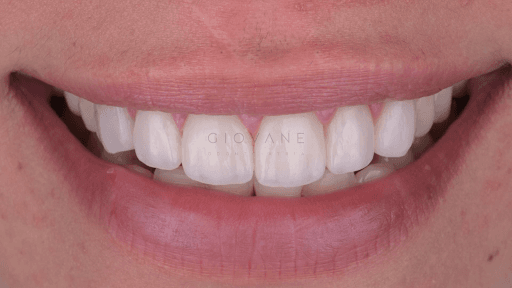 Studio Dentistico GIOVANE odontoiatria logo