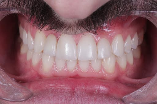 Studio Dentistico Dr Calabrese Davide smile & lips logo