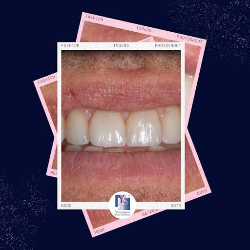 Studio Dentistico - Faccette dentali logo