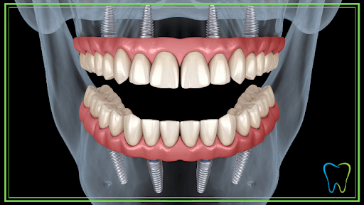 Studio Dentistico Riparazione Protesi Dentarie logo